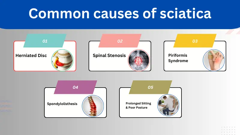 list of commen causes of sciatica pain