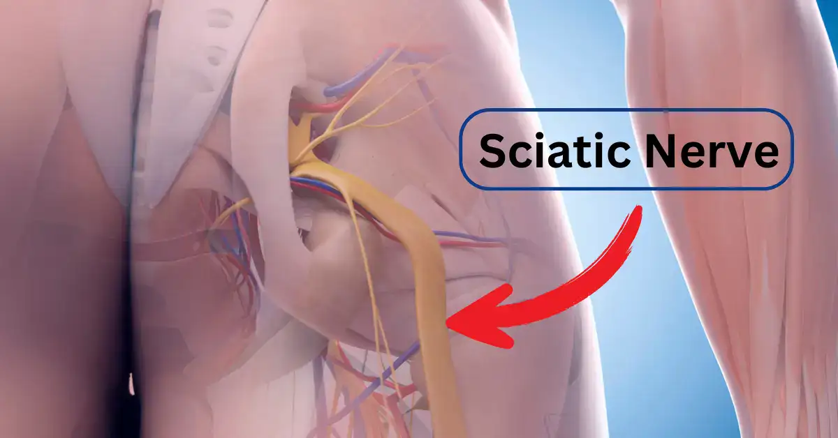 Physiotherapy for Sciatica Pain and Nerve compression